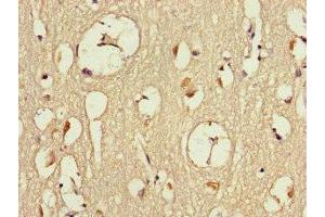 Dmx-Like 2 antibody  (AA 2471-2657)