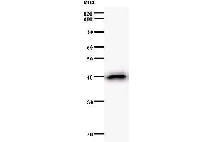 Image no. 1 for anti-Small Nuclear RNA Activating Complex, Polypeptide 4, 190kDa (SNAPC4) antibody (ABIN930927)