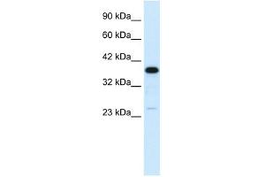 Image no. 2 for anti-Complement Component 4 Binding Protein, beta (C4BPB) (N-Term) antibody (ABIN634490)