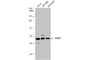 Image no. 1 for anti-Matrix Metalloproteinase 2 (MMP2) (Center) antibody (ABIN2855854)