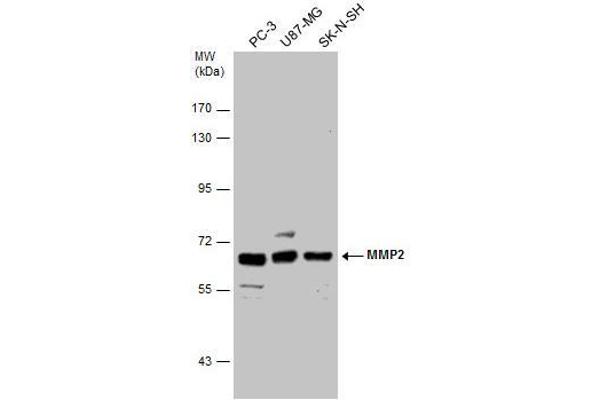 anti-Matrix Metalloproteinase 2 (MMP2) (Center) antibody