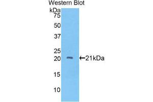 Image no. 1 for anti-ADAM Metallopeptidase with thrombospondin Type 1 Motif, 12 (ADAMTS12) (AA 827-1001) antibody (ABIN1857901)