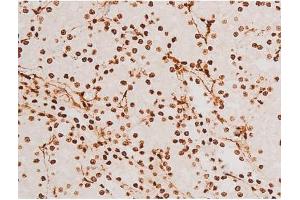 Image no. 1 for anti-Spleen tyrosine Kinase (SYK) (pTyr348) antibody (ABIN6255895)