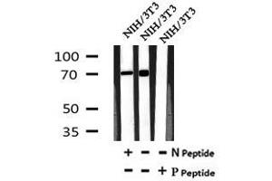 Image no. 4 for anti-Nuclear Receptor Subfamily 2, Group C, Member 2 (NR2C2) (pSer192) antibody (ABIN6269651)