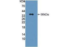 Image no. 2 for anti-Insulin Receptor Substrate 2 (IRS2) (AA 985-1255) antibody (ABIN5013744)