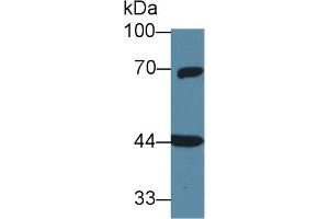 Image no. 3 for anti-Guanine Nucleotide Binding Protein (G Protein), alpha 11 (Gq Class) (GNA11) (AA 1-359) antibody (ABIN1868197)