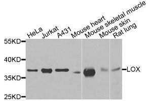 Image no. 1 for anti-Lysyl Oxidase (LOX) antibody (ABIN6143288)
