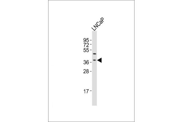 LGALS8 Antikörper  (C-Term)
