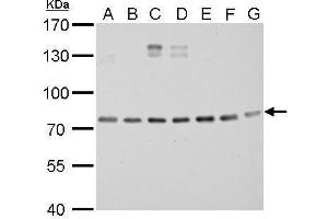 anti-DNA Repair Protein Complementing XP-B Cells (ERCC3) (C-Term) antibody