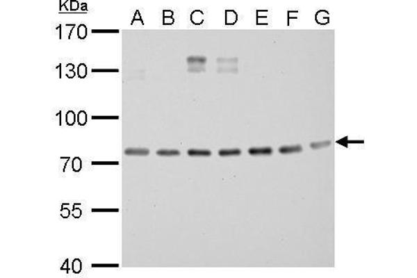anti-DNA Repair Protein Complementing XP-B Cells (ERCC3) (C-Term) antibody