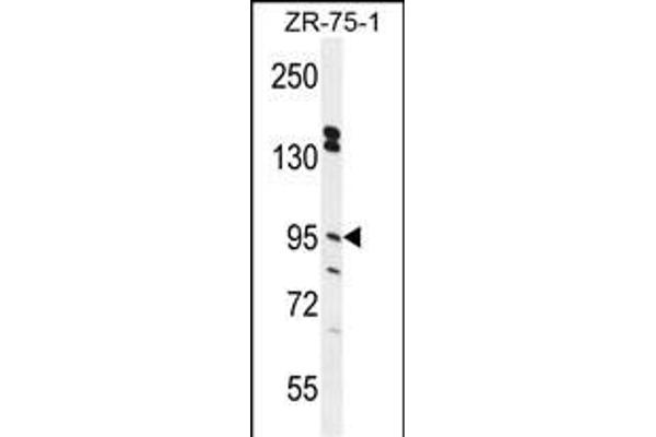 ERMP1 antibody  (C-Term)
