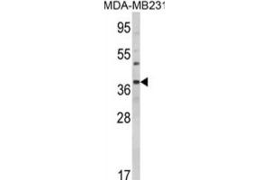 Image no. 2 for anti-BCL2-Associated Athanogene (BAG1) antibody (ABIN3001708)