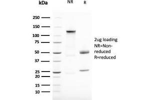Image no. 5 for anti-Vimentin (VIM) antibody (ABIN6940885)
