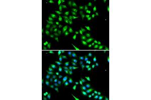 Image no. 6 for anti-KIAA1456 (KIAA1456) antibody (ABIN2563549)