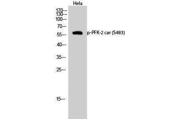 anti-6-phosphofructo-2-Kinase/fructose-2,6-Biphosphatase 2 (PFKFB2) (pSer483) antibody