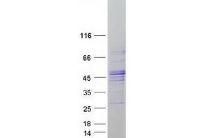 Image no. 1 for F-Box Protein 31 (FBXO31) protein (Myc-DYKDDDDK Tag) (ABIN2720955)