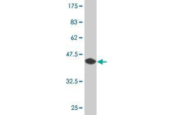Creatine Kinase MB anticorps