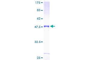 NOTCH2NL Protein (Notch 2 N-terminal Like) (AA 1-236) (GST tag)