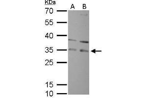 Image no. 3 for anti-Replication Protein A2, 32kDa (RPA2) (Center) antibody (ABIN2856881)
