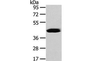 Vasohibin 2 antibody