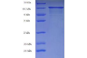 Image no. 1 for Immunoglobulin Heavy Constant gamma 1 (G1m Marker) (IGHG1) (AA 1-479), (full length) protein (His-SUMO Tag) (ABIN5709729)