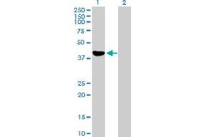 Image no. 2 for anti-Alcohol Dehydrogenase 1C (Class I), gamma Polypeptide (ADH1C) (AA 1-375) antibody (ABIN513127)