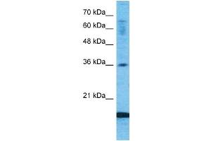 Image no. 5 for anti-Chemokine (C-C Motif) Ligand 18 (Pulmonary and Activation-Regulated) (CCL18) (Middle Region) antibody (ABIN2792202)