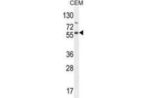 Image no. 3 for anti-Nuclear Factor of kappa Light Polypeptide Gene Enhancer in B-Cells Inhibitor-Like 1 (NFKBIL1) (AA 256-289), (Middle Region) antibody (ABIN953695)