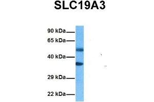 Image no. 3 for anti-Solute Carrier Family 19, Member 3 (Slc19a3) (Middle Region) antibody (ABIN2775519)