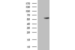 Image no. 4 for anti-4-Aminobutyrate Aminotransferase (ABAT) (AA 29-323) antibody (ABIN2715601)