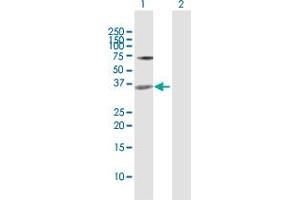 Image no. 3 for anti-Mesenchyme Homeobox 2 (MEOX2) (AA 1-303) antibody (ABIN950145)