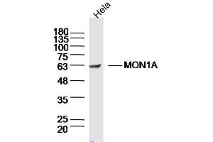 Image no. 1 for anti-MON1 Homolog A (MON1A) (AA 51-150) antibody (ABIN5675674)