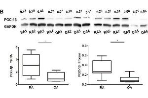 Image no. 1 for anti-Peroxisome Proliferator-Activated Receptor Gamma, Coactivator 1 beta (PPARGC1B) (AA 901-1023) antibody (ABIN872354)