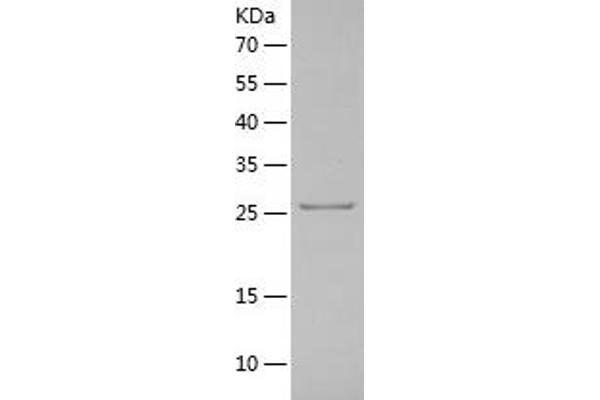 Kallikrein 2 Protein (KLK2) (AA 25-261) (His tag)