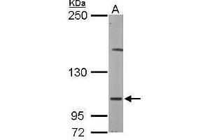 Image no. 4 for anti-Eukaryotic Translation Initiation Factor 4 gamma 2 (EIF4G2) (C-Term) antibody (ABIN2855138)