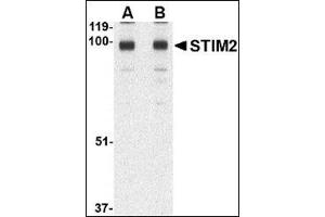Image no. 2 for anti-Stromal Interaction Molecule 2 (Stim2) (C-Term) antibody (ABIN500829)