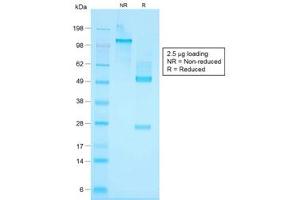 Image no. 2 for anti-Keratin Basic antibody (ABIN4949251)
