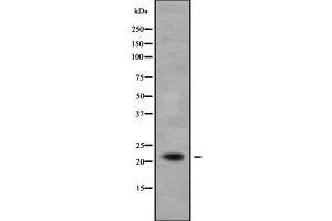 Image no. 1 for anti-Neurocalcin delta (NCALD) antibody (ABIN6263529)