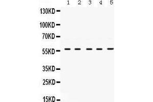 Image no. 3 for anti-Lymphocyte-Specific Protein tyrosine Kinase (LCK) (AA 468-506), (C-Term) antibody (ABIN3043870)