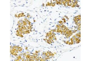 Immunohistochemistry of paraffin-embedded Rat ovary using Fibronectin Polyclonal Antibody at dilution of 1:100 (40x lens).