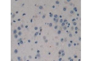 Image no. 3 for anti-Aminopeptidase Puromycin Sensitive (NPEPPS) (AA 584-755) antibody (ABIN1176248)