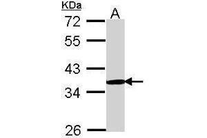 Image no. 2 for anti-Proteasome (Prosome, Macropain) 26S Subunit, Non-ATPase, 11 (PSMD11) (C-Term) antibody (ABIN2855081)
