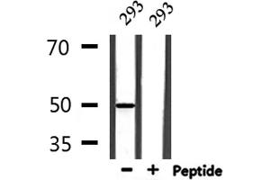 Image no. 1 for anti-Coenzyme Q8A (COQ8A) antibody (ABIN6258497)