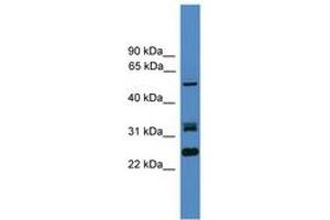 Image no. 1 for anti-Leucine Rich Repeat (In FLII) Interacting Protein 2 (LRRFIP2) (AA 51-100) antibody (ABIN6745323)