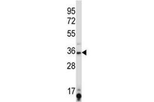 Image no. 3 for anti-Sirtuin 6 (SIRT6) (AA 276-305) antibody (ABIN3032596)