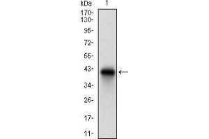 Image no. 5 for anti-HLA-DR-gamma (CD74) (AA 1-106) antibody (ABIN1724870)