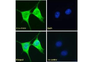 Image no. 3 for anti-Patched 1 (PTCH1) (C-Term) antibody (ABIN185521)