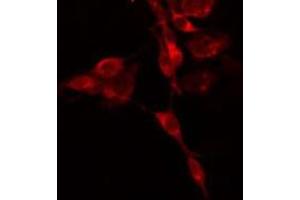 Image no. 1 for anti-Guanine Nucleotide Binding Protein (G Protein), alpha Inhibiting Activity Polypeptide 3 (GNAI3) (N-Term) antibody (ABIN6258933)