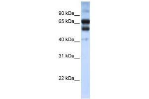 Image no. 1 for anti-Retinoic Acid Receptor, gamma (RARG) (N-Term) antibody (ABIN2780350)