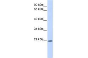 ZNF534 抗体  (AA 101-150)